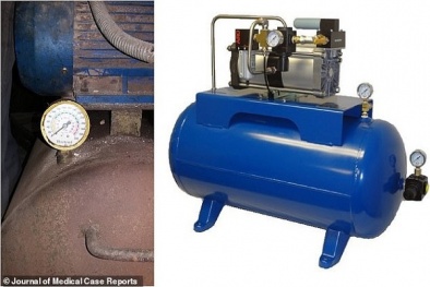 Người đàn ông nổ trực tràng vì 'nghịch dại' với máy nén khí công nghiệp