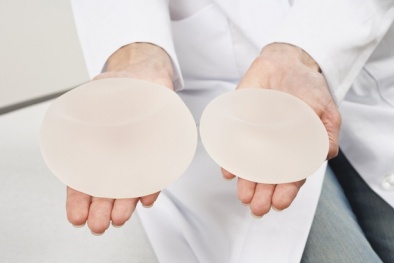 Nâng ngực, phụ nữ có nguy cơ mắc ung thư