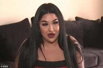 Bảy phụ nữ bị nhiễm trùng môi sau khi tiêm chất làm đầy rẻ tiền