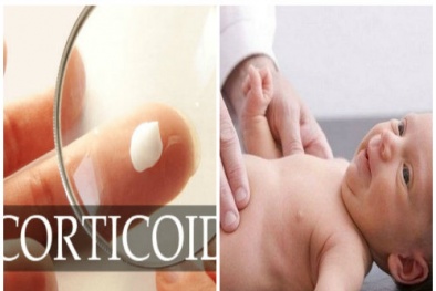 Trẻ có thể bị ngộ độc toàn thân nếu dùng thuốc bôi ngoài da có thành phần corticoid
