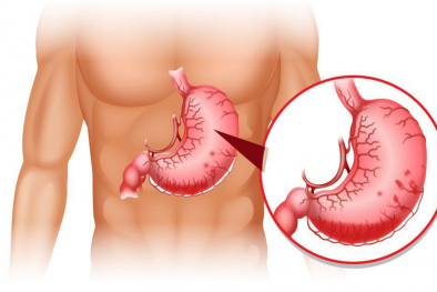 6 dấu hiệu báo động về dạ dày