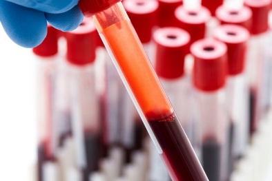 Sử dụng nam châm để loại bỏ ung thư khỏi cơ thể