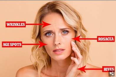 Khói bụi khiến da hình thành đồi mồi và lão hóa nhanh không ngờ