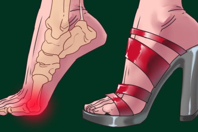 Các bộ phận cơ thể có thể bị hủy hoại khi đi giày cao gót