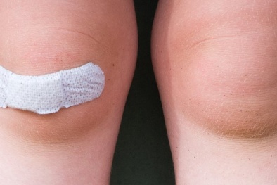 Kỳ lạ loại băng gạc thông minh có khả năng phát hiện nhiễm khuẩn