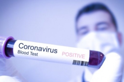 Việt Nam có thể tự sản xuất bộ kit test nhanh virus corona