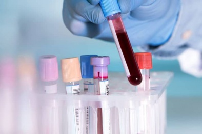 Việt Nam sẽ có thêm bộ kit test nhanh virus corona trong tháng 2?