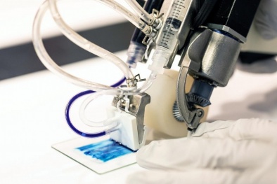 Công nghệ độc đáo: In 3D trực tiếp tế bào lên vết thương để điều trị bỏng