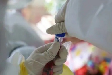 Chuẩn bị thử nghiệm thuốc điều trị HIV cho virus corona