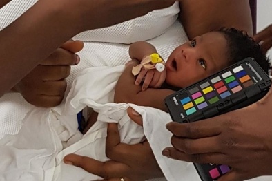 Ứng dụng điện thoại đặc biệt giúp chẩn đoán chính xác bệnh vàng da ở trẻ em