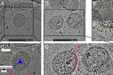 Ảnh hiển vi đầu tiên cho thấy hình dạng thật của virus corona