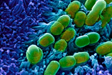 Lần đầu tiên AI phát hiện kháng sinh có khả năng ‘đánh bại’ các chủng vi khuẩn