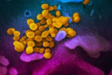 Que thử xét nghiệm nCoV trong 20 phút