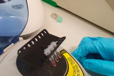 Chế tạo thành công bộ kit xét nghiệm nhanh Sars-Cov-2, cho kết quả nhanh gấp 3 lần bình thường 