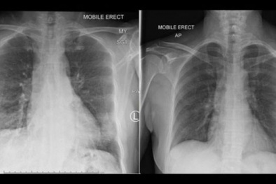 Hệ thống miễn dịch của con người chống lại virus corona chủng mới như thế nào?