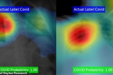 Áp dụng trí tuệ nhân tạo vào việc phát hiện Covid-19 nhanh chóng và chính xác