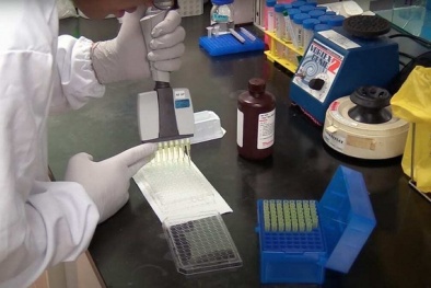 Phát hiện 5 kháng thể có khả năng ngăn chặn sự lây nhiễm và đột biến của Covid-19