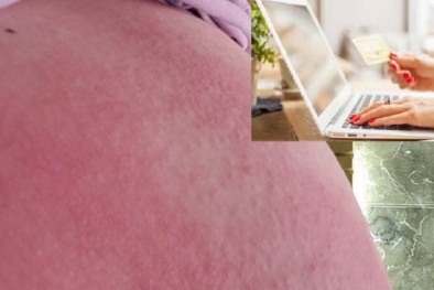 Hiểm họa từ sản phẩm làm đẹp trên mạng nhưng nhiều chị em vẫn 'không chừa'