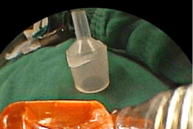 Cảnh báo: Không cho trẻ chơi điện thoại đồ chơi bằng nhựa có lắp bóng đèn LED