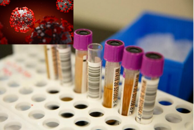 Một kháng thể được sử dụng để tạo ra thuốc có thể vô hiệu hóa hoàn toàn Covid-19