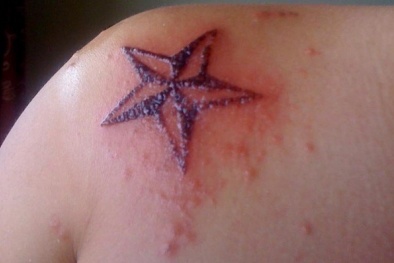 Dễ mắc 6 bệnh này từ phun xăm không an toàn 