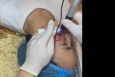 Thẩm mỹ Mr. Sheeo: Ngang nhiên thực hiện dịch vụ xâm lấn cơ thể trái phép? (Bài 2)