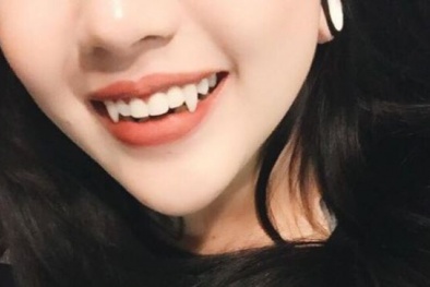 Nguy cơ độc hại từ trào lưu gắn răng nanh giả bằng nhựa