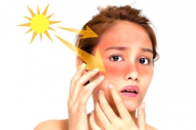 Phát hiện Vitamin B3 bảo vệ tế bào da khỏi tác động của tia cực tím