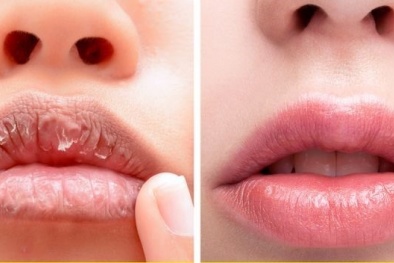 Sử dụng dầu xả, son dưỡng môi quá nhiều gây tác hại không tưởng