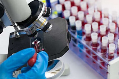 ISO 17822: Đánh giá kết quả chính xác trong phòng thí nghiệm y tế