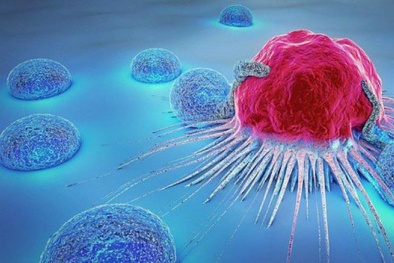 Ung thư gan vì thói quen dùng gừng để lâu trong bếp pha trà uống hàng ngày