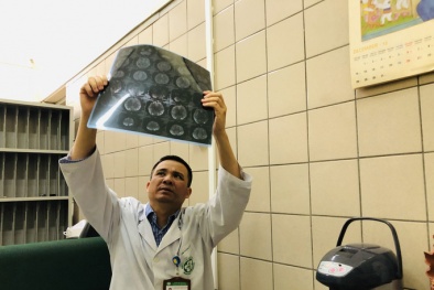 Cảnh báo trường hợp thanh niên 29 tuổi tử vong vì ngộ độc rượu