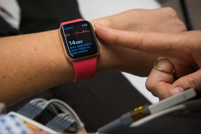 Phát hiện sớm triệu chứng COVID-19 nhờ đồng hồ thông minh