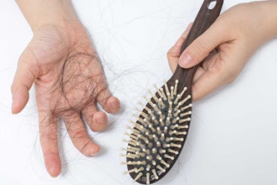 Covid-19 có thể gây chứng rụng tóc