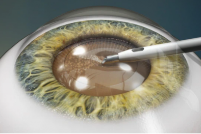 Thiết bị thông minh tạo thị lực nhân tạo giúp người mù nhìn thấy mọi vật dễ dàng