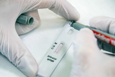 Chế tạo thành công thiết bị đặc biệt phát hiện kháng thể chống virus SARS-CoV-2