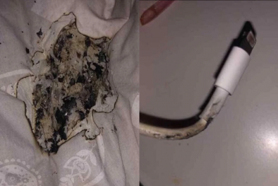 Sạc điện thoại iPhone phát nổ khiến thiếu nữ bị bỏng mặt 