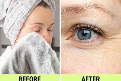 Da mặt bị tổn thương, nhiễm khuẩn nếu dùng khăn bông khô lau mặt sai cách 