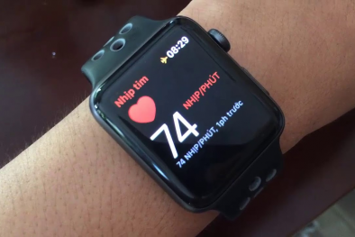 Apple Watch có thể theo dõi tình trạng tim mạch của bệnh nhân 