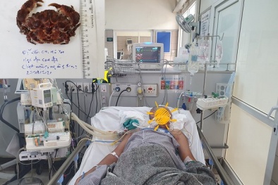 Nguy kịch do ăn cua mặt quỷ dù đã được luộc chín