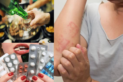 Những bất lợi khi dùng thuốc chống dị ứng Diphenhydramin cùng với rượu