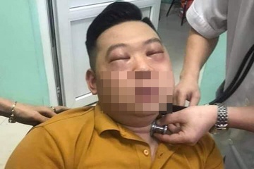 Tác dụng phụ nguy hiểm của hành tây ít ai ngờ