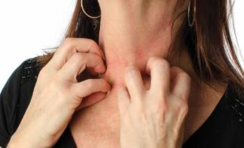 Viên uống ngăn ngừa sốc phản vệ mang lại hy vọng mới cho những người bị dị ứng nặng