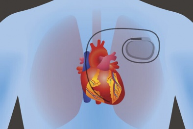 Vật liệu thông minh thúc đẩy việc 'sản xuất' điện trong cơ thể người