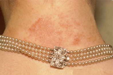 Cảnh báo nguy cơ nhiễm độc từ trang sức giá rẻ trên thị trường