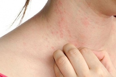 Quần áo chưa đạt chuẩn có thể gây ung thư: Làm sao để nhận biết?