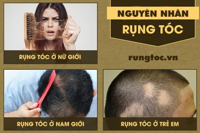 Loạn quảng cáo sản phẩm chữa tóc bạc sớm, rụng tóc