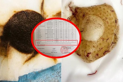 Giun sán trong nước sinh hoạt KĐT Pháp Vân - Tứ Hiệp: Lộ kết quả kiểm định nước chứa vi khuẩn vượt chục lần quy chuẩn 