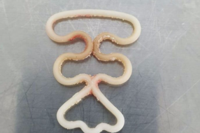 Cảnh báo rủi ro khi dùng vòng tránh thai sai cách