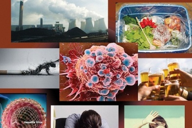 5 tác nhân gây ung thư con người phải đối mặt hàng ngày